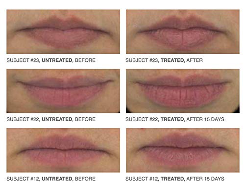 Restorsea Pro Lip Magic with Vibransea Complex