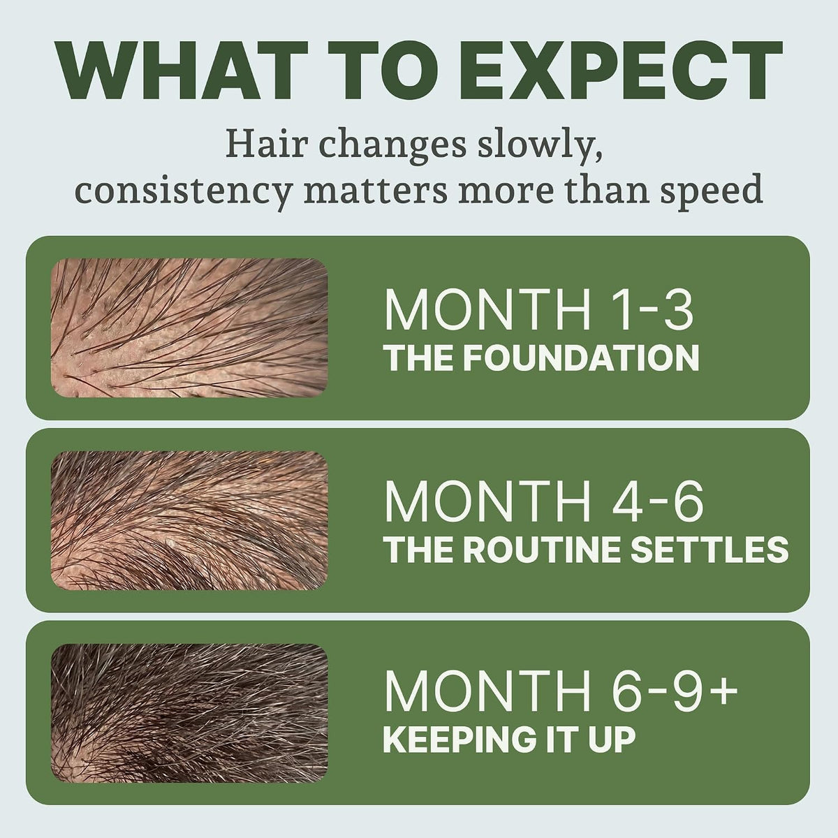 Men’s Hair Regrowth Growth System for 90 Days