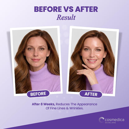Cosmedica Skincare Peptide Serum with Matrixyl 3000 & Hyaluronic Acid, 2oz
