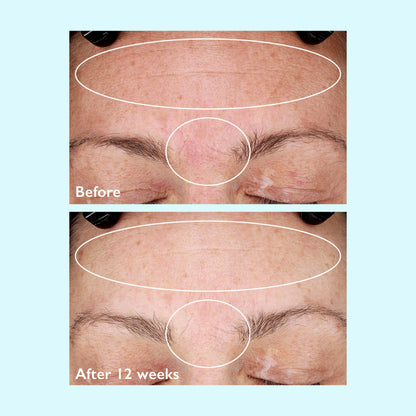 Restorsea Rejuvenating Day Cream with Vibransea Complex