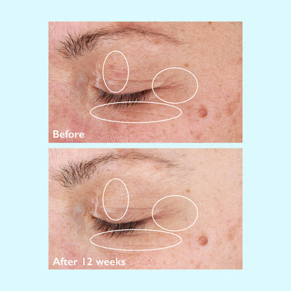 Restorsea Revitalizing Eye Cream 0.5 oz