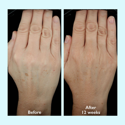 Restorsea PRO Intensive Hand Treatment 10x