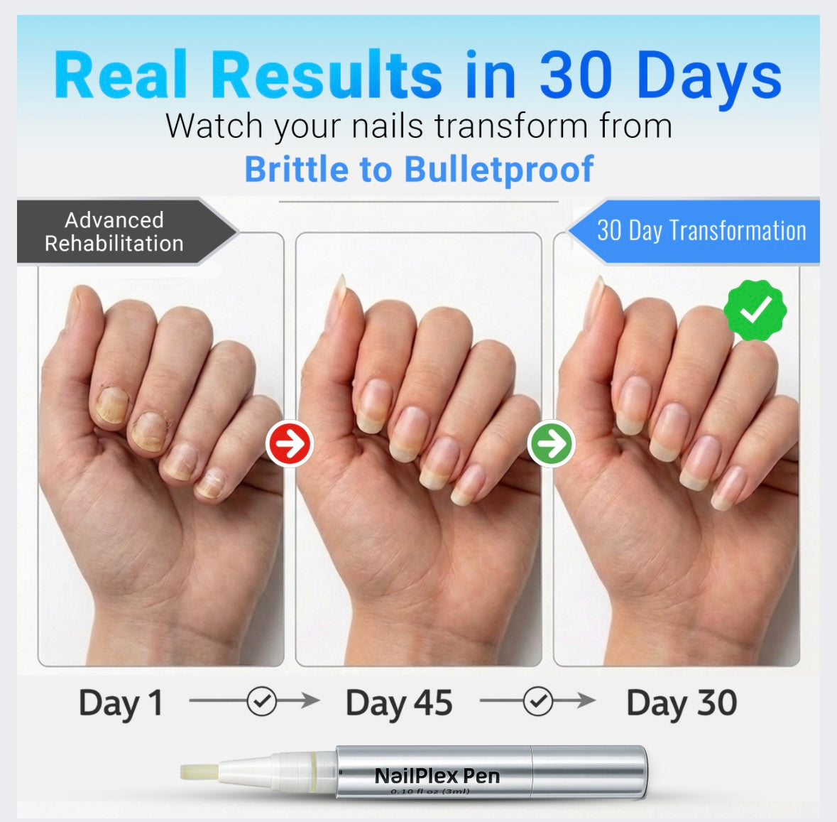 NailPlex Shield Nail Strengthener & Nail Repair Advanced Formula Treatment Pen 3ml (2 Pack)