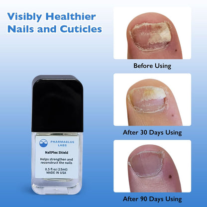 NailPlex Shield Nail Strengthener & Nail Repair Advanced Formula Treatment