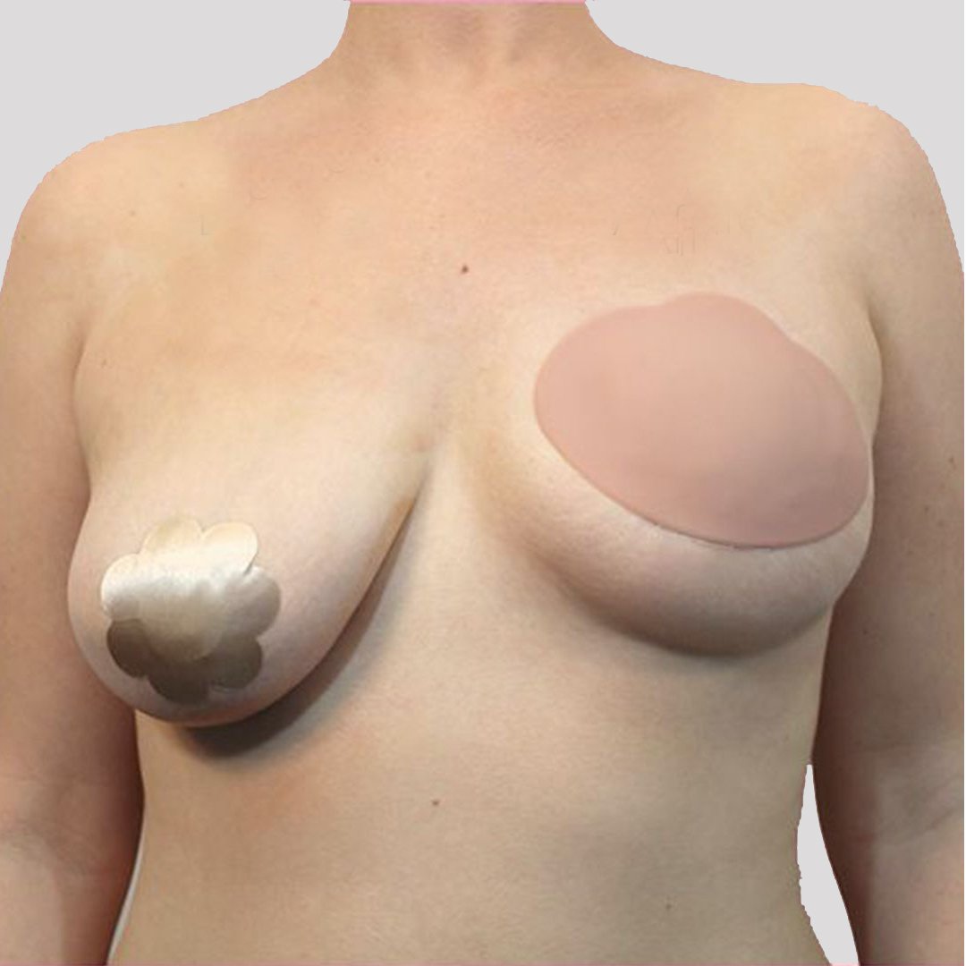 Bring it Up Breast Shapers, Nude - DD